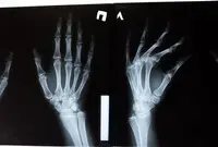 Ilustrasi X-Ray