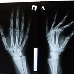 Ilustrasi X-Ray