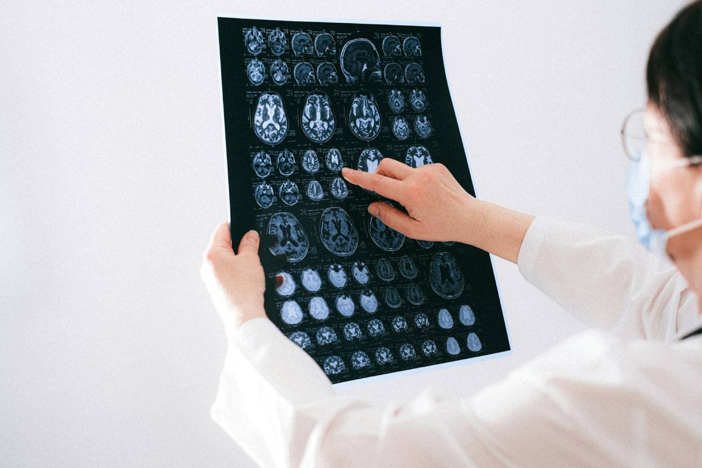 Spesialis Saraf (Neurologist)